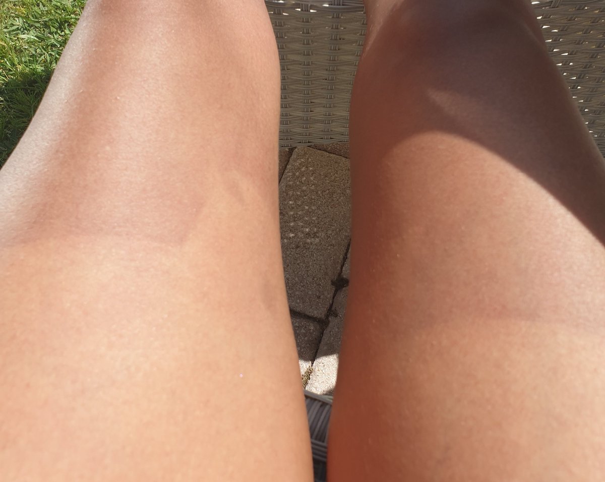Billy0Joe's tweet photo. #fail #TanLineFan https://t.co/odOuZTKrrF