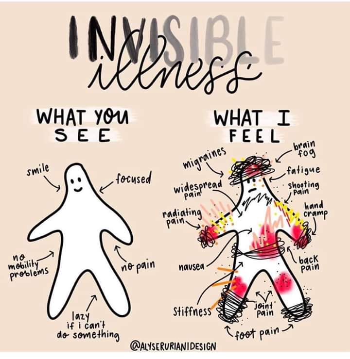 shasharimaa's tweet photo. #Lupus #sle 
nobody know what i feel https://t.co/aoududDPFj