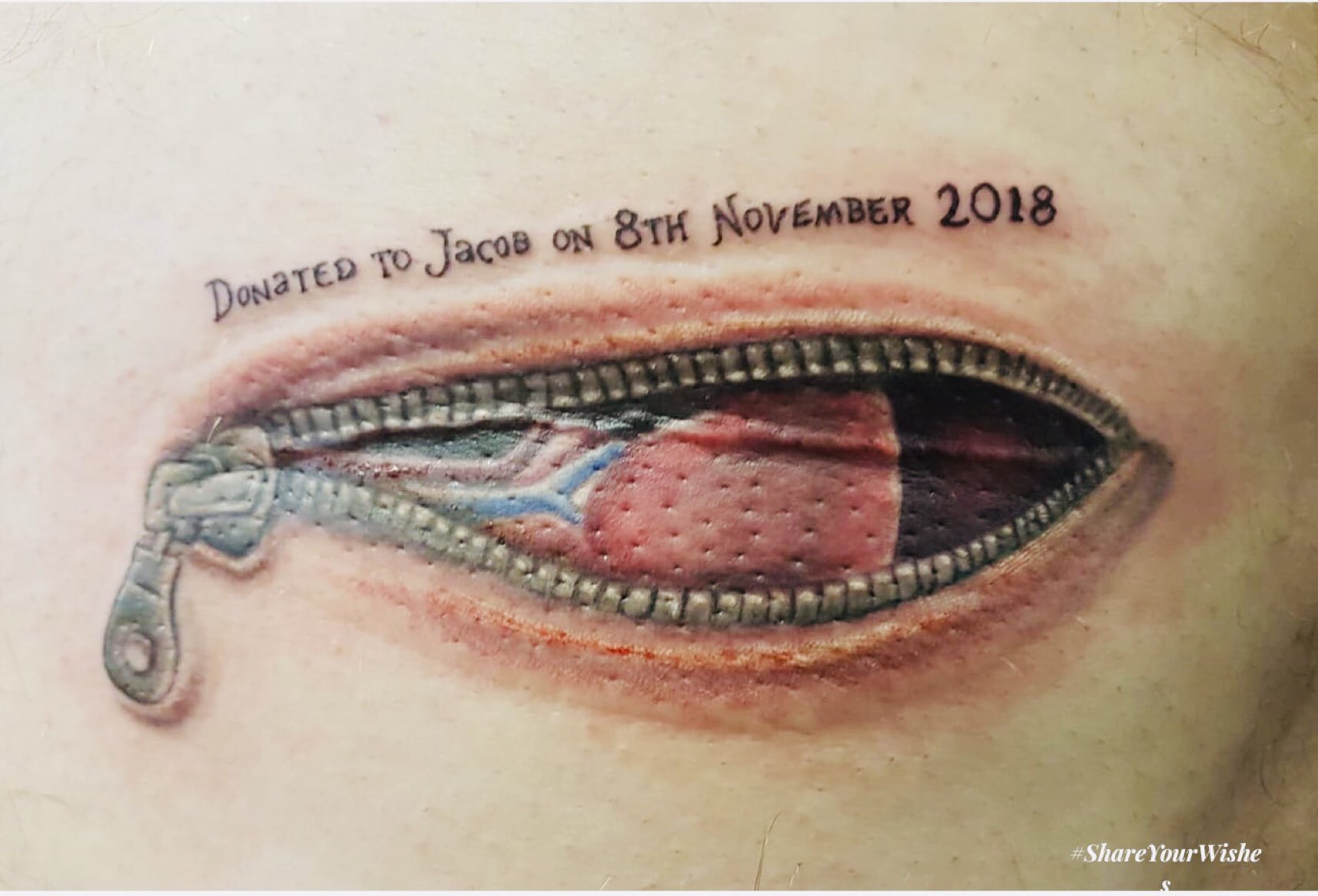 Grantham doctor gets inked up to raise awareness of organ donation