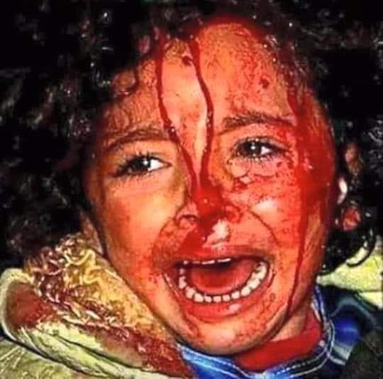 SAFIALDIIN's tweet photo. بأموال آل سلول و زايد والسيسي قصف بيتها وأصيب أهلها ودمرت مدرستها ومدينتها وقتل جيرانها وعذبت في طفولتها ...أليس هذا هو الإرهاب بعينه
حسبنا الله
#طرابلس_تحت_القصف https://t.co/1GI8DTWKur