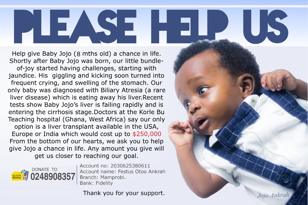 KafuiDey's tweet image. Can you help Baby Jojo?