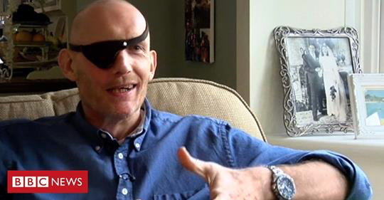 TSPS_2018's tweet photo. More insights into Johns amazing story. He really is an inspiration His book FACE CANCER released (Amazon) 3rd May, with ALL net proceeds going to cancer charities #Facecancer #ThursdayMotiovation 
https://t.co/CEGJZgEk6z https://t.co/2Gj4jOen4K