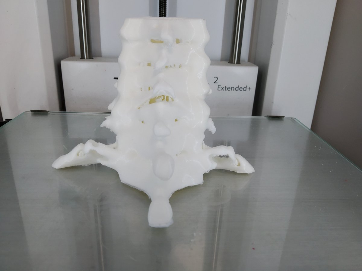 3d_maranon's tweet photo. 3D model of a spine from C3 to Th1 of a patient that sufferd a compression fracture in the C7 and a posterior fracture in the C6. This model allows a more accurate evaluation of the lession. #HospitalMarañon3D FabLab team: @rupermac @calvoharo_ja @diegotrap @sandrasv97 @kn_ord https://t.co/raSpxqtEyk