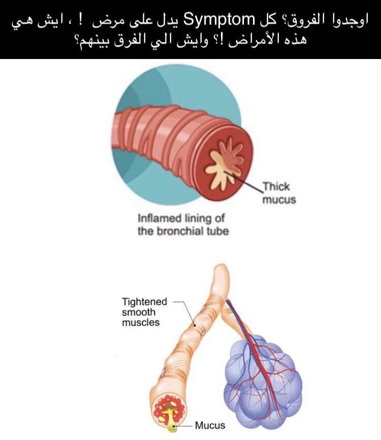 ASMA_933's tweet photo. #اوجدوا_الفروق ؟ 
  ?#what_are_the_diffrence 
These are symptoms of two different diseases, what are they?
#الرعاية_التنفسية #العلاج_التنفسي 
#respiratory #respiratorytherapy #rrt #respiratorycare #respiratorytherapystudens #respiratorytherapist https://t.co/sh384hFE50