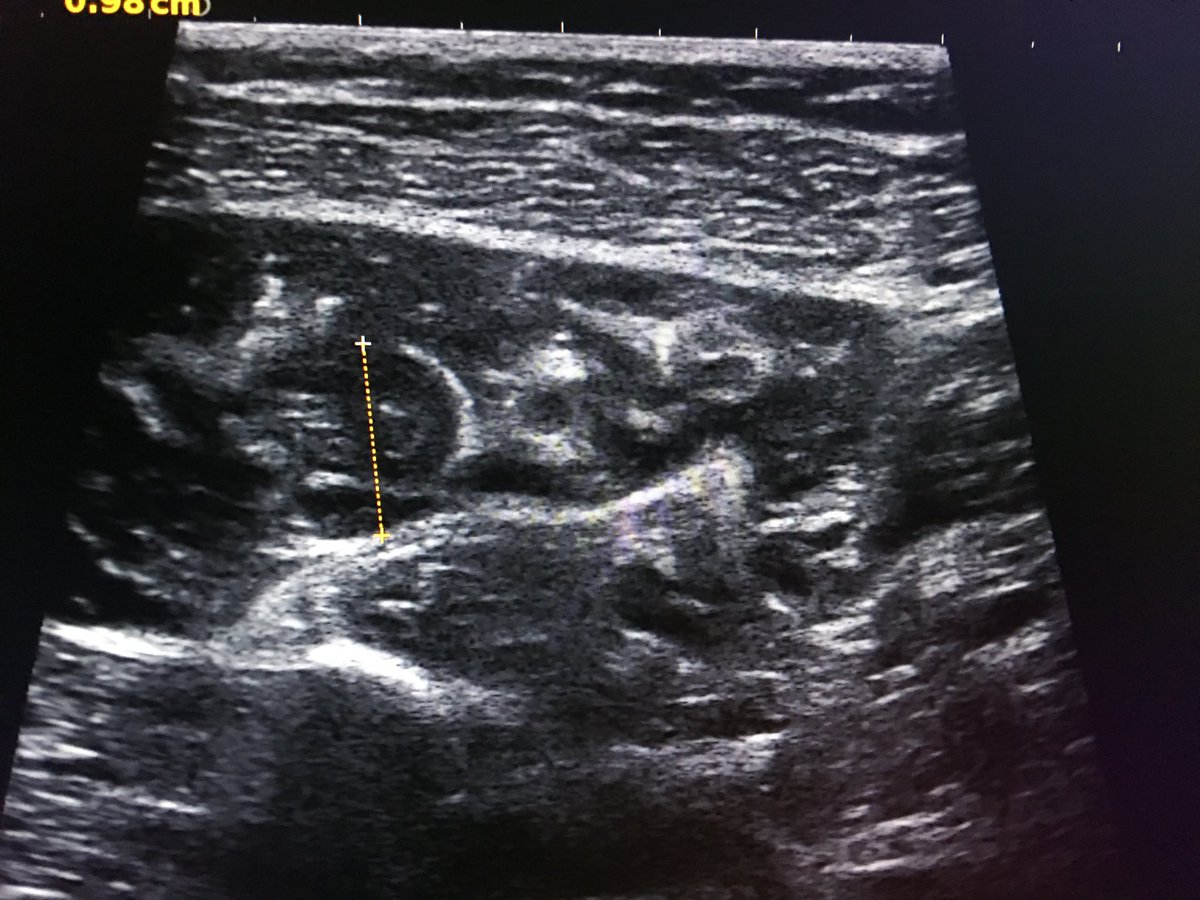 Dr Jean Pierre Laroche tweet media