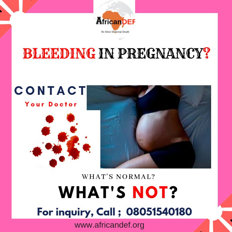 drvickie_feyi's tweet photo. Spotting is a common concern that many pregnant women face. Approximately 20% of women report they experience spotting during their first 12 weeks of pregnancy. It is considered spotting when you notice a few drops of blood occasionally in your underwear.
#AfricanDEF #ACMD https://t.co/ozfRF0KxrK