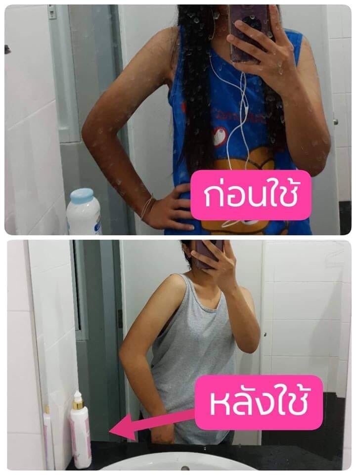 NNaramol's tweet photo. ตอนนี้ใครเป็นแบบนี้อยู่ รีบมาหาซื้อเดอะไวท์ไปทาเลยจ้าาาา 
#บอกลาผิวทูโทนช่วงสงกรานต์ #ครีมขาว #ครีมบำรุง #ขาวไว #howtoperfact #HowtoPerfect #ดำแค่ไหนก็ขาวได้ #ดำแดด #ดีบอกต่อ #ส่งฟรี https://t.co/yEQwXpMBvQ