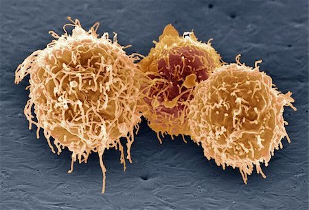 SciImmunology's tweet image. Irregularities in B cell activity may help explain the beginnings of a rare #autoimmune disorder #APECED with symptoms that range from persistent #Candida infection to #thyroid issues, @YaleIBIO @YaleMed scientists found: fcld.ly/qvl7zez