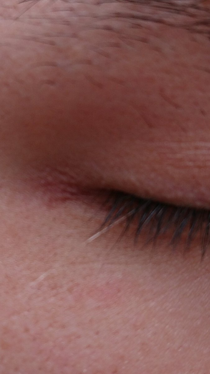 熊澤 玄徳 閲覧注意 お見苦しいですが お分かり頂けるだろうか なんとまつ毛に白い毛が しかも長ーい 今の今まで気がつかなかった ロ これを見たあなたにも良いことがありますように まつ毛 宝毛 T Co Lc2rwtt1le Twitter