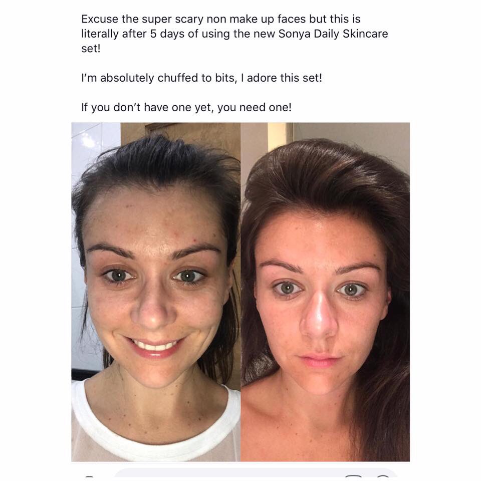aloe_believer's tweet photo. Sonya Daily #gelbased skincare for #combination skin #aloebeliever https://t.co/Q9bAuJ3YuB