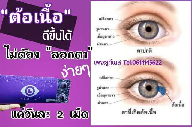 GunG_Budsara's tweet photo. ก่อนจะเป็น.. #ต้อเนื้อ
เราดูแล​ ดวงตา​ ของเราได้
ก่อนเกิดอาการ...

#ลูทีเนส​ 1เม็ด.. 
ป้องกันแสงสีฟ้าได้นาน 8 ชั่วโมง
#ลูทีเนส​ วันละ 1 เม็ด​ ดูแลดวงตา
ป้องกันการเกิดอาการ
#ต้อลม​ และ​ #ต้อเนื้อ

#ลูทีเนส​ดีที่สุด​สำหรับ​ดวงตา
#สอบถาม​สั่งซื้อ​โทร​06141 456 22 https://t.co/UunfF6Wgt2