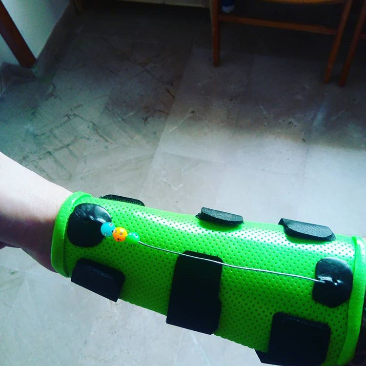 Orfit's tweet photo. Active motion made pretty! @TerapiadManozgz creates orthoses that are both fun and practical in the way they stimulate movement. Read more about active motion here >> https://t.co/yNDcIMg4Dl
#activemotion #orthoticfabrication #occupationaltherapy #handtherapy #splinting https://t.co/0KVhjldWpH
