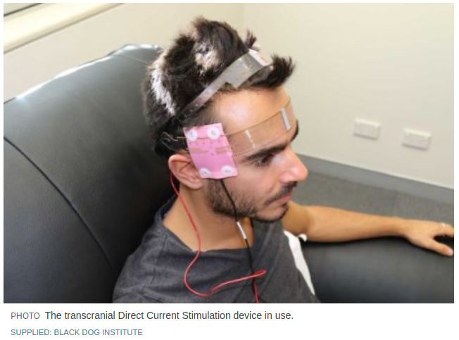 DepressionLTE's tweet photo. Press article on the remote-supervised trial https://t.co/GEQGwvdwkD The photos clearly show the take-home package,the fixed electrode position EASYstrap headgear &amp; EASYpads. Each component includes critical technology necessary for tolerated &amp; consistent performance #depression https://t.co/7X2dIxwoe5