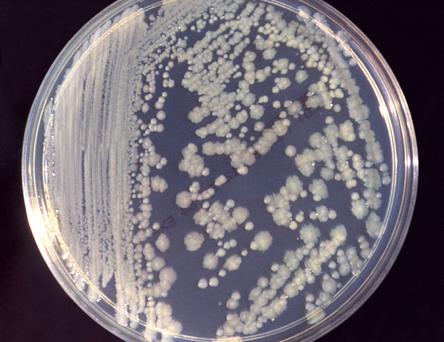 DiscoverMag's tweet photo. Antibiotic-resistant Bacteria Found on Space Station Toilet - D-brief https://t.co/7GWEU8LuV4 https://t.co/Rbs1MvmcJQ