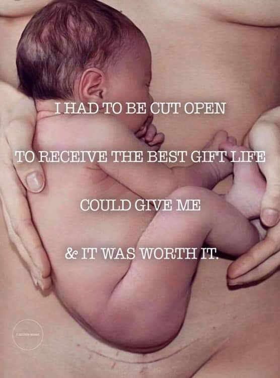 Vikkitoria2794's tweet photo. #csectionmomma #bestgift https://t.co/roBHdIzcim