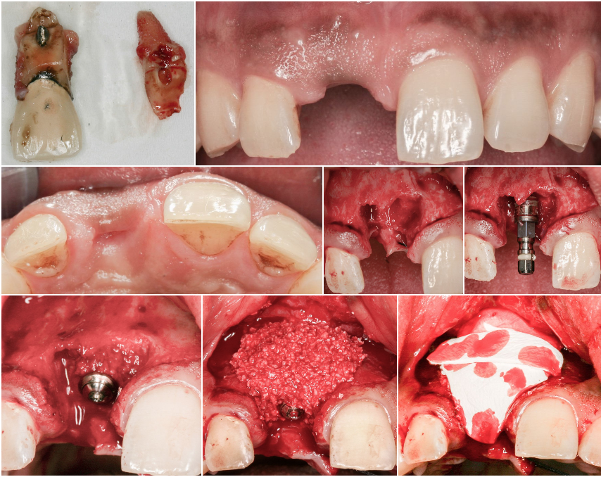 PerioSpot | Dental Insights tweet media