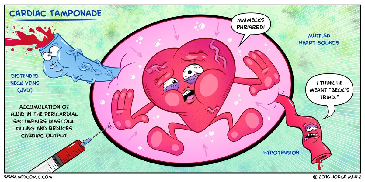MedComic's tweet photo. Cardiac Tamponade
https://t.co/ycwYqLBwj9 https://t.co/ANcx8Jm3YU