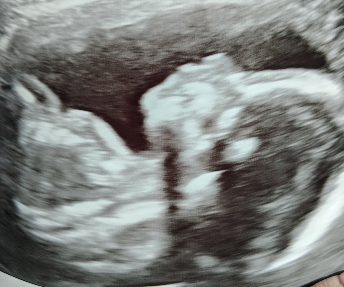 dianecip's tweet photo. @joshgroban Maybe include a warning there to gird your loins! My husband brought me to that November MSG show as a bday gift... So now our daughter is due August 12. 😄 https://t.co/GXu0GB5IR9