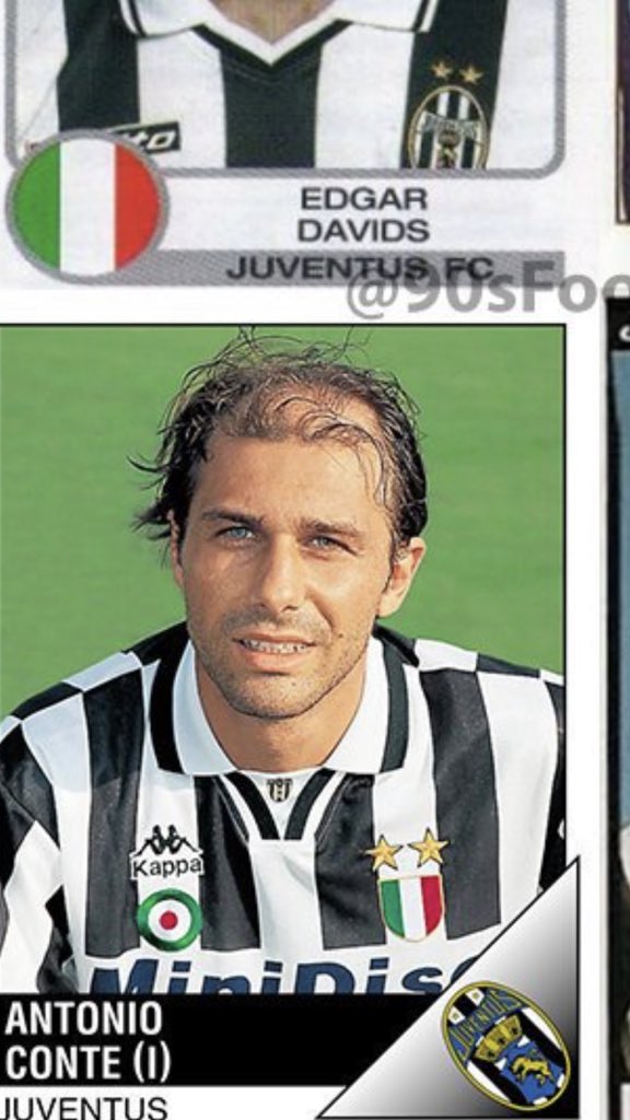Scoo7er23's tweet photo. @90sfootball @Chall2007 A reminder Conte has the best hair transplant on the planet. https://t.co/AjFAtlbjrH