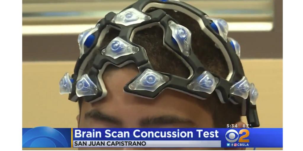 BaslyneTest's tweet image. The key to managing and monitoring your brain performance is to measure it overtime to identify changes in your brain’s performance including cognition. Sign up for your scan at baslyne.com