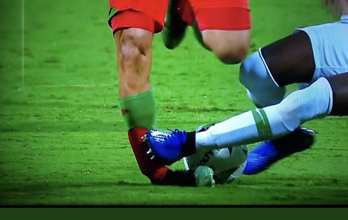 campoeliasjr's tweet photo. FRACTURA DE PERONÉ!!! Sería el dictamen médico de BRAYAN FERNÁNDEZ después de esta infracción ayer en el duelo ante Nacional. ERA ROJA DIRECTA!!!! el juez solo sacó amarilla. https://t.co/67adhsEtWD