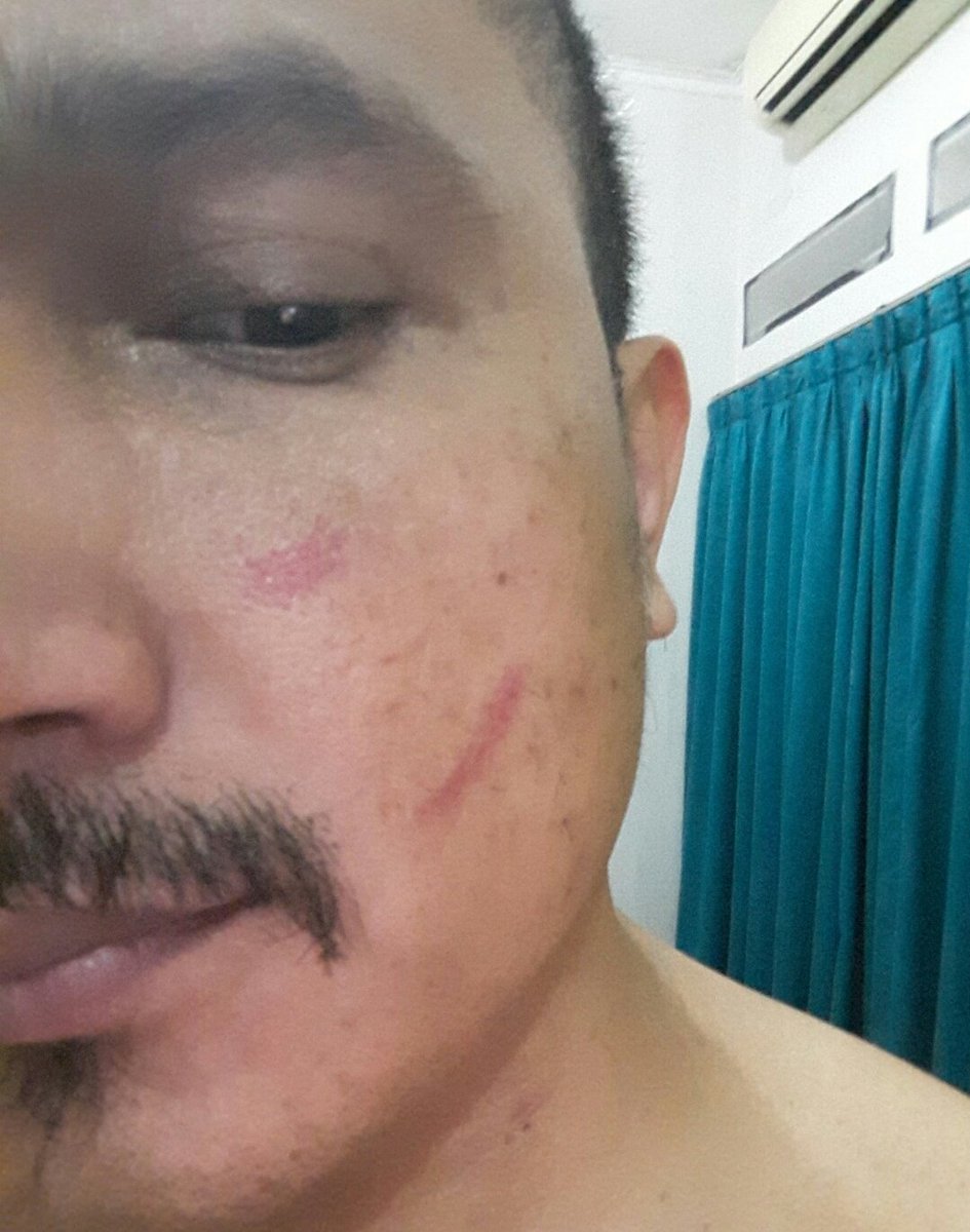 BasDeddy's tweet photo. @FerdinandHutah2 Lebih malu lagi klu ada Orang seperti Kolor merah..mau jadi apa Negara ini... https://t.co/Cji9YcPg1y