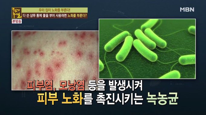 pannatic's tweet photo. Don't fill your empty shampoo bottle with water and use it again.

The bottle has ‘green bacteria’ which cause dermatitis and inflammation. However if you’re using a refill, you can wash the containers and dry them in the sun. That way you can prevent the growth of the bacteria. https://t.co/halVt4UGGk