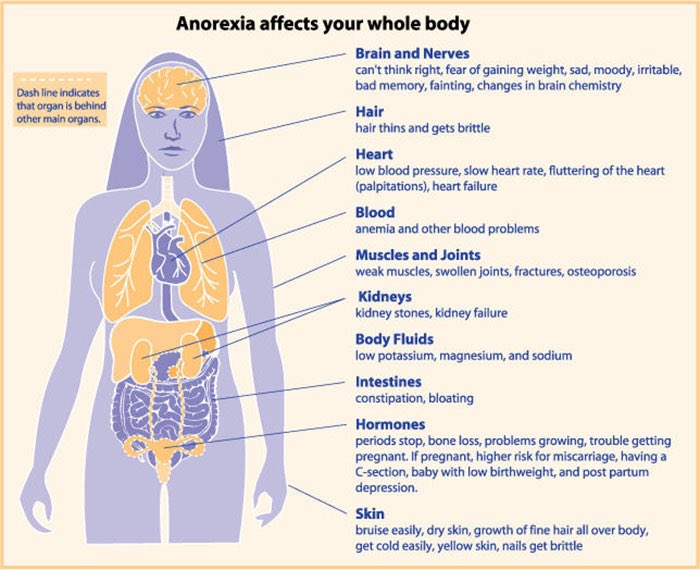 hiddendisorder's tweet image. Eating disorders don’t just allow you to lose weight, there are many serious affects that come with it. Below are some serious health problems that come along with bulimia and anorexia. Please share the info amongst your peers #educate #SLSSENG2D