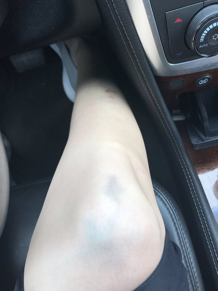 fitnesswmeliss's tweet photo. Kickboxing class directly after an Upper body workout and 😅 #mamastired 
#andsore 
#bruisedknees https://t.co/tAQTWj26V0