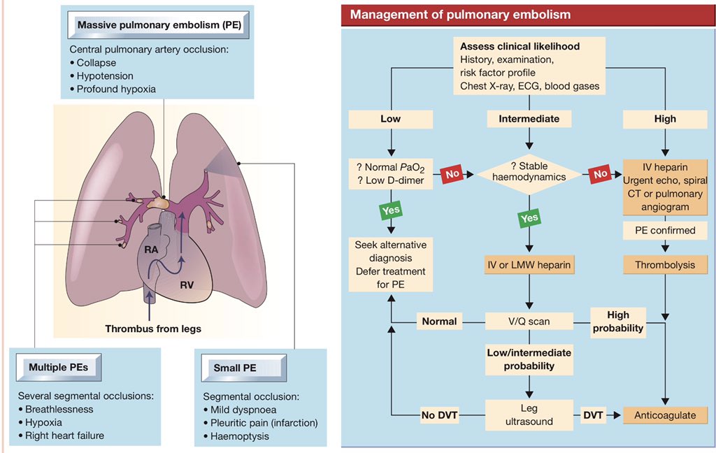 Pulmonary Embolism Flow Chart