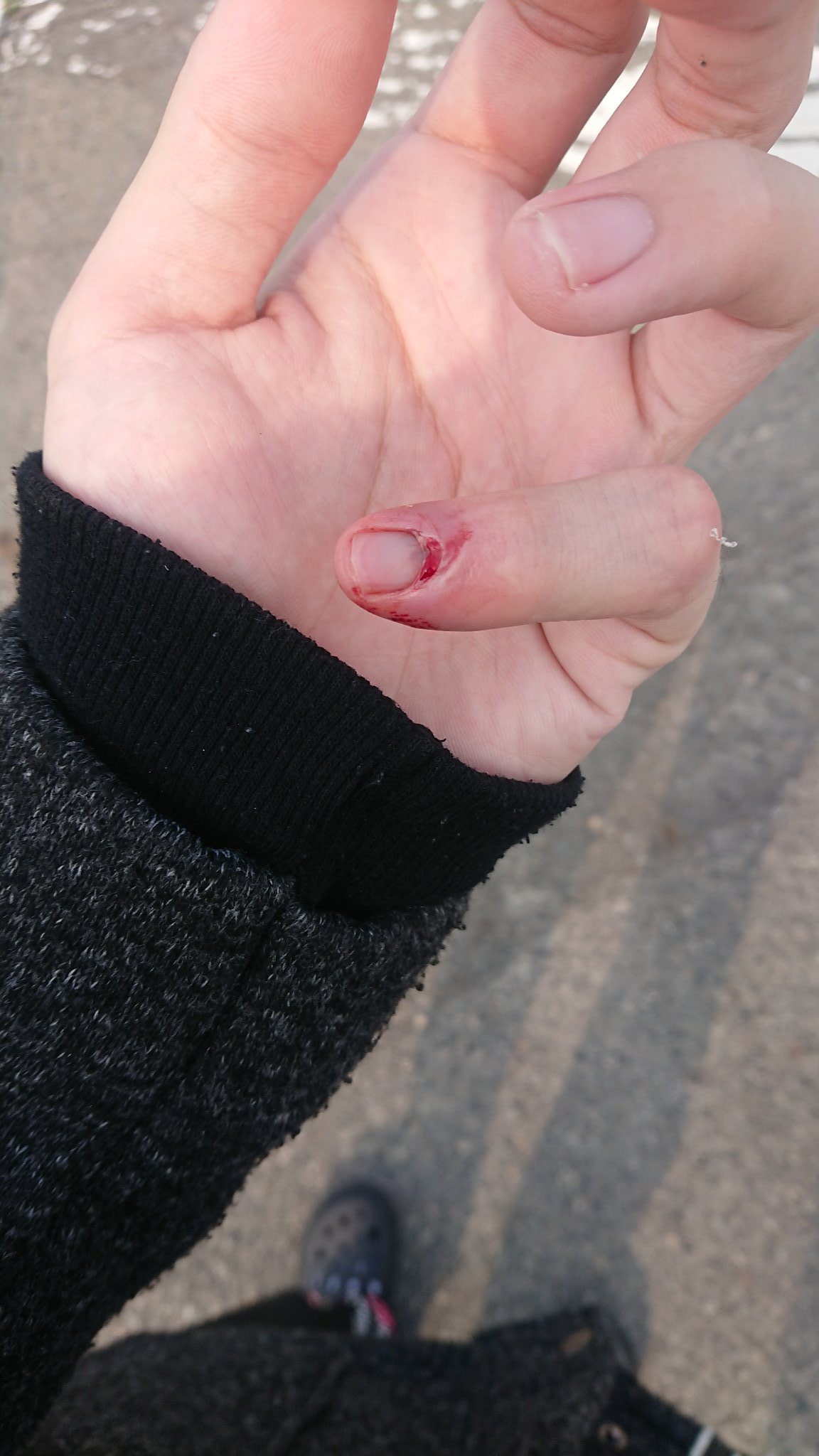 Twitter 上的 ぐんそー さてさて 朝からグロいもんでも載せてやるぜ T Co Iftq58j9rl Twitter