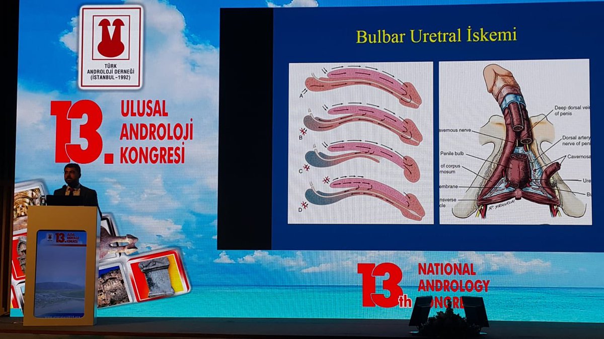 13th National Andrology Congress#urethralstricture#uretroplasty#newsurgicaltechniques#reconstruction