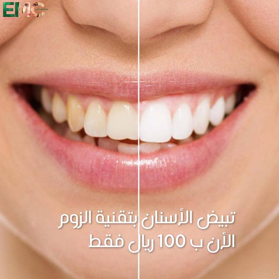 emc_oman's tweet photo. لا تفوتوا عروضنا المميزة
في جميع الفروع 
مع استشارة مجانية لطبيبة الأمراض النسائية و التوليد و التجميل النسائي.
للحجز: 24604540
MOH:150/2019 https://t.co/xnjaVHUbiT