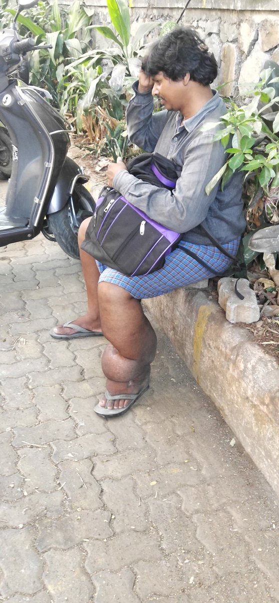 firozeshakir's tweet photo. Majid my beggar friend
He has the best smile besides carrying the weight of this huge humongous leg #elephantisis
He bathes every morning at a sweet water outlet Bandra #Bandstand.
Washes his clothes than begs at #MountMary
I tell his story.. https://t.co/lLkvhuDuZq