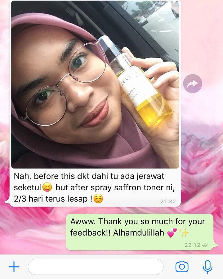 KaymanBeauthyra's tweet photo. Wow! JERAWAT TERUS HILANG Alhamdulillah
Penggunaan #saffrontoner 2,3 hari je jerawat dah segan segan malu nak timbul 😆😆
-
Korang kena cuba dulu &amp; rasai sendiri perbezaannya 💕
-
Saffron toner, 100ml
RM28 SM / RM32 SS
-
Interested?
📲 Dm, Whatsapp 0133916758 https://t.co/vkjvep8fpm
