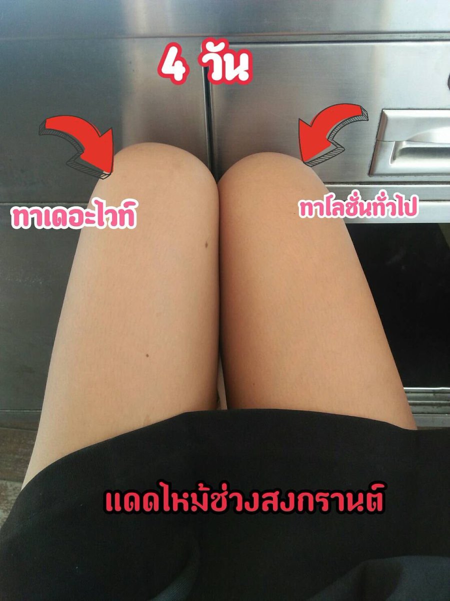 NNaramol's tweet photo. ขาวขึ้นได้เพราะเดอะไวท์เพียวๆ สมัยนี้เขาไม่พอกบีๆกันแล้วจร้า #howtoperfact #ฉันจะขาว #howtopefect #ครีมขาว #ขาวไว #ขาวใส #ของมันต้องมี #ของดีต้องบอกต่อ #พร้อมส่ง #ส่งฟรี #ครีมบำรุง #ทักมาเลย https://t.co/nb84zQk6vk