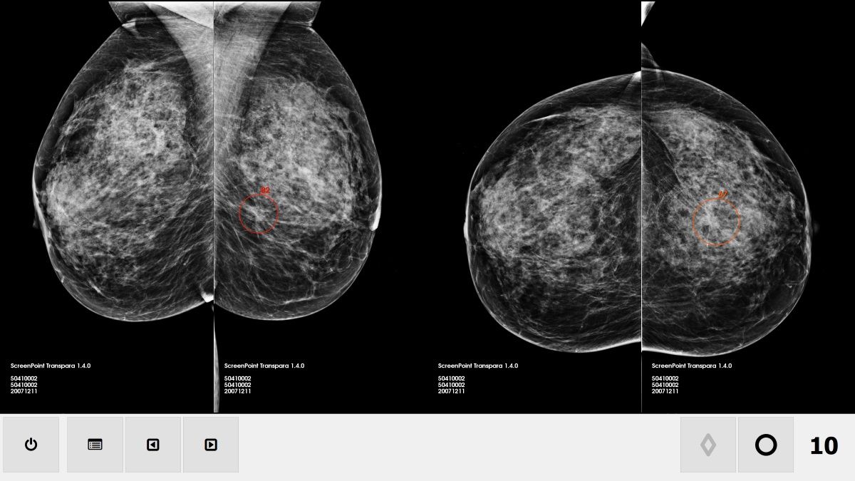 SpirosMargaris's tweet photo. Good read

#ArtificialIntelligence versus 101 #radiologists 

https://t.co/k1x2MumKPF #fintech #insurtech #AI #MachineLearning #Deeplearning #robotics @PhysicsWorld #healthcare @ahier @jblefevre60 @pierrepinna @YuHelenYu @alvinfoo @andi_staub @KMcDSAP @DianeKazarian https://t.co/HcXFJrkAkv
