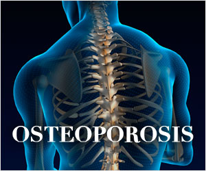 Spine2019's tweet photo. Most common cause of kyphosis in adults form a #vertebral fracture due to osteoporosis. This can occur in both men and women.Osteoporosis weakens
vertebrae are susceptible to fracture that typically occurs in a wedge shape with front of vertebra collapsing and losing its height. https://t.co/rNGFUDnCHV