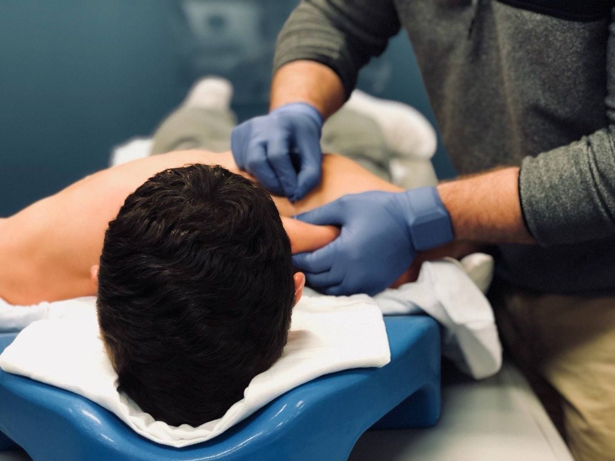 LincolnPTSR's tweet photo. Functional dry needling can be a useful technique to remedy muscle tension in the upper body and lower body! Tight calves, tight quads, knee pain? Give us a call and see if you need this treatment to be your best for the Marathon or Half Marathon! Available at all 4 locations! https://t.co/5FtUKCztQL