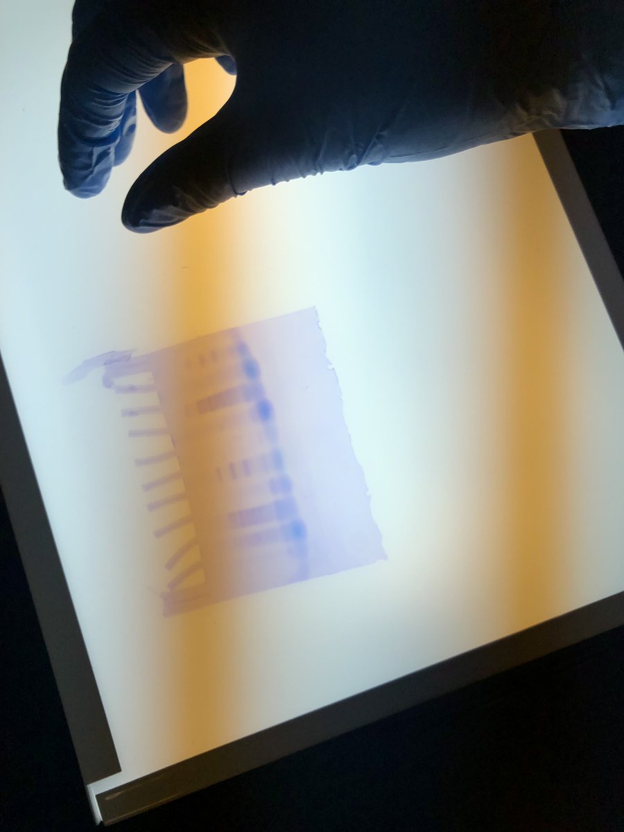 MkcCoyle's tweet photo. 4.1.4 Gel Results #rhsbms https://t.co/R7jimcoJsy