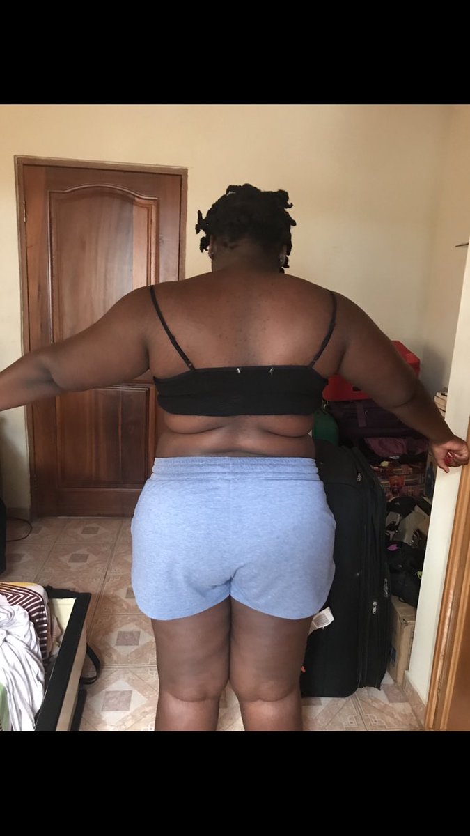 melanin__aries's tweet photo. I lost 28kg / 61 lbs in 6 months! I changed my diet and went gym 5/6 times a week. I’m lighter and much happier now 🥰🥰

#weightloss #motivation https://t.co/DUjfyBYMZs