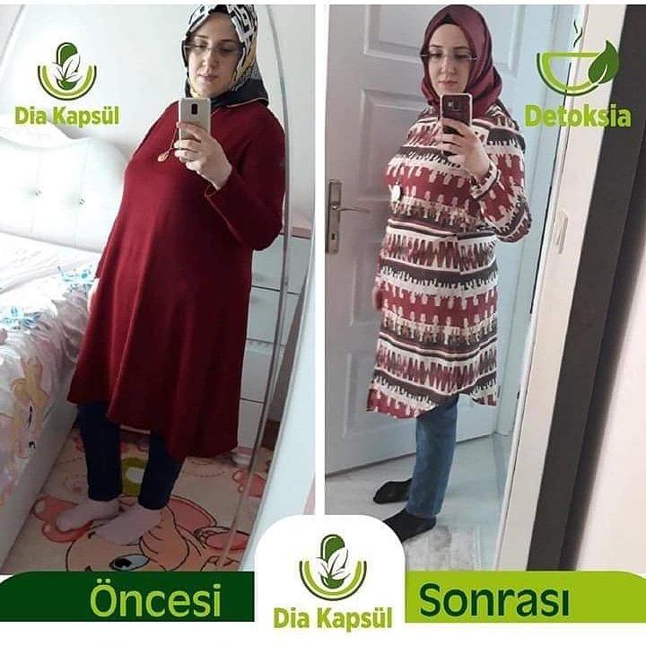 DetoksiaG's tweet photo. Gamze hanım 1 kutu kapsül çeyrek çay kullanım sonucu - 8 kilo 😍
Polikistik over sendromu, Insulin direnci ve emziren anne
Üstelik düzensiz kullanım 🙂
Tebrikler canım👏👏👏
DETAYLI BİLGİ İÇİN 
MESAJ GÖNDEREBILIRSINIZ https://t.co/CRnI8B9cUS