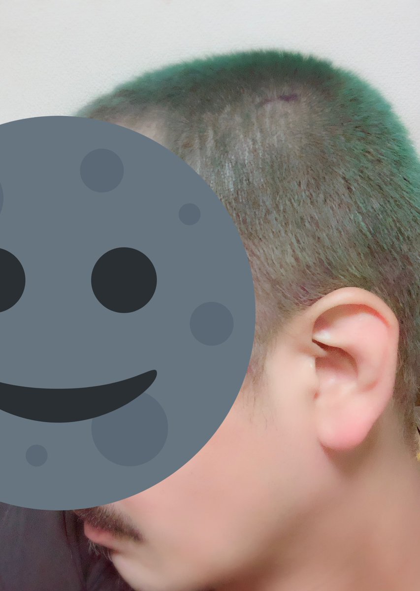 ちょげ Sur Twitter 髪の毛がカビみたいな色になってしまったのですがどうすればいいでしょうか おしえてミュークラブ ちょげ Sur Twitter 髪の毛がカビみたいな色になってしまったのですがどうすればいいでしょうか おしえてミュークラブ