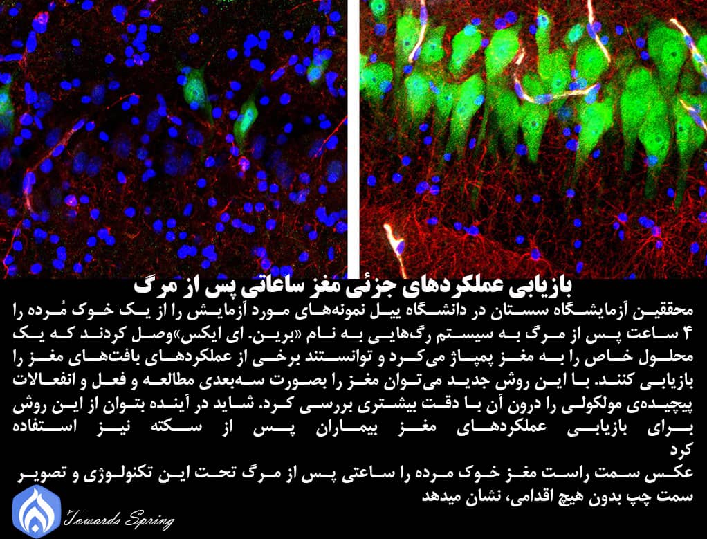Bahar_Media's tweet photo. 📚بازیابی عملکردهای جزئی مغز ساعاتی پس از مرگ!
🖊️محققین به تازگی توانستند برخی عملکردهای بافت های مغز یک خوک مرده را ۴ ساعت پس از مرگ، بازیابی کنند.
#اخبار_علمی
#مغز
#BrainEx https://t.co/uSKfphEs6E