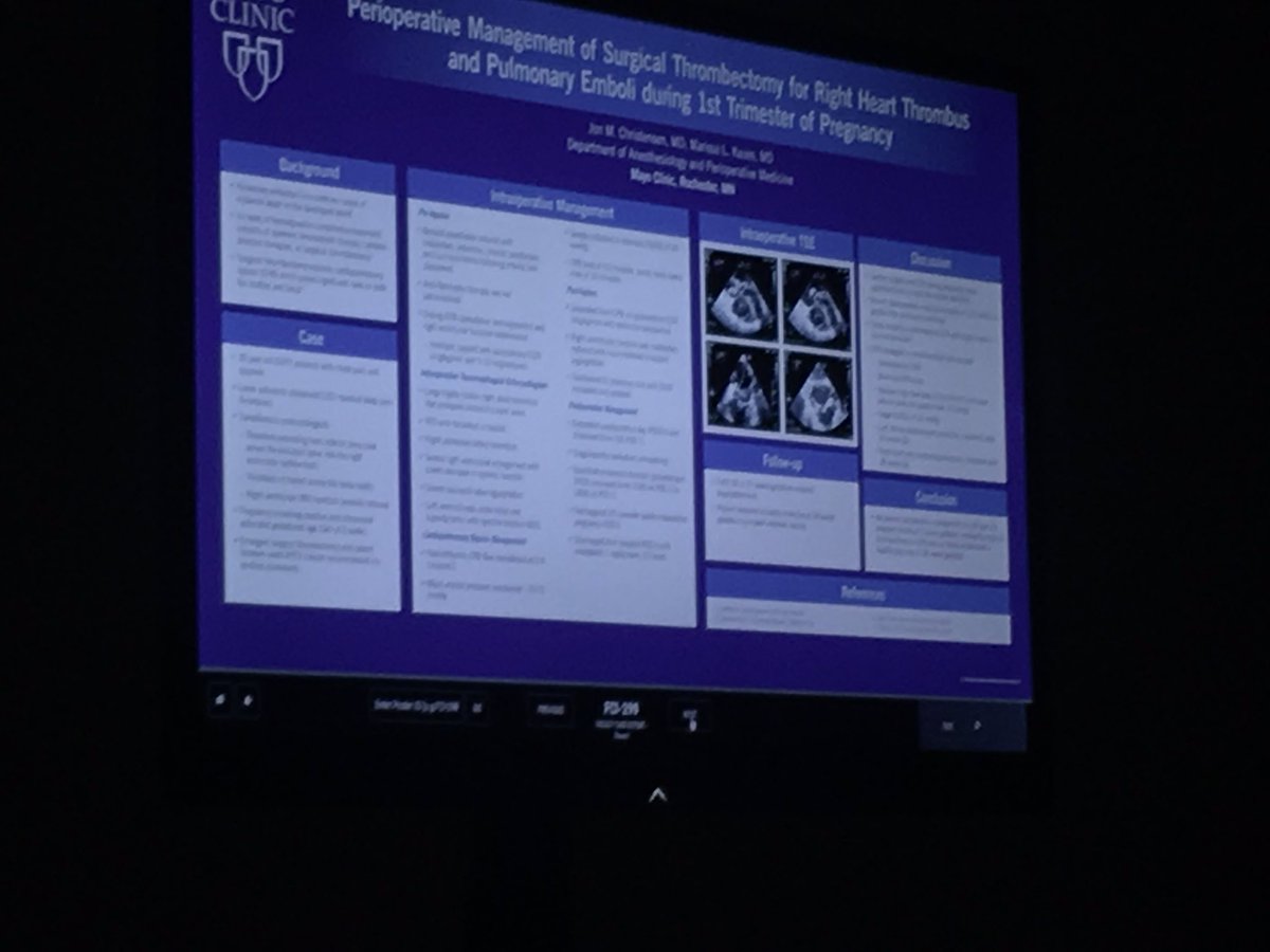 mackenziequale's tweet photo. Dr Jon Christensen, Cardiac fellow at Mayo Clinic, presenting OB patient needing thrombectomy for PE in first trimester. OB trained or not, all types of anesthesiologists will encounter pregnant patients! @SOAPHQ #MayoAnes #SOAPAM19 https://t.co/Pa3ikJcHFh