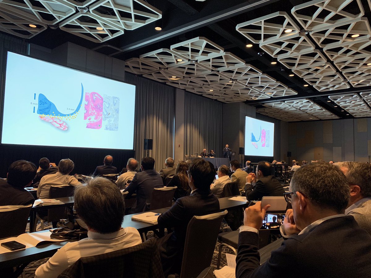 Akshay Sood (@sood11) on Twitter photo <a href="/MMenonMD/">Mani Menon</a> talks to a full house about precision prostatectomy <a href="/DrFAbdollah/">Firas Abdollah</a> <a href="/jamesopeabody/">jamesopeabody</a> <a href="/urojeong/">Wooju Jeong</a> <a href="/dPuch/">Dan Pucheril</a> <a href="/CraigRogersMD/">Craig Rogers MD</a> <a href="/qdtrinh/">Quoc-Dien Trinh, MD, MBA</a> <a href="/DrSohrab/">Sohrab Arora</a> <a href="/MMenonMD/">Mani Menon</a> talks to a full house about precision prostatectomy <a href="/DrFAbdollah/">Firas Abdollah</a> <a href="/jamesopeabody/">jamesopeabody</a> <a href="/urojeong/">Wooju Jeong</a> <a href="/dPuch/">Dan Pucheril</a> <a href="/CraigRogersMD/">Craig Rogers MD</a> <a href="/qdtrinh/">Quoc-Dien Trinh, MD, MBA</a> <a href="/DrSohrab/">Sohrab Arora</a>