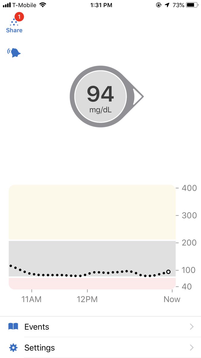 AmyDBMine's tweet photo. OK, so #EversenseCGM has me consistently at 10-20 points lower #BGnow than @dexcom Hmmm... And YES, I am currently wearing them both while getting acclimated to #omnipodloop #openomni https://t.co/tVcEsXVIWq