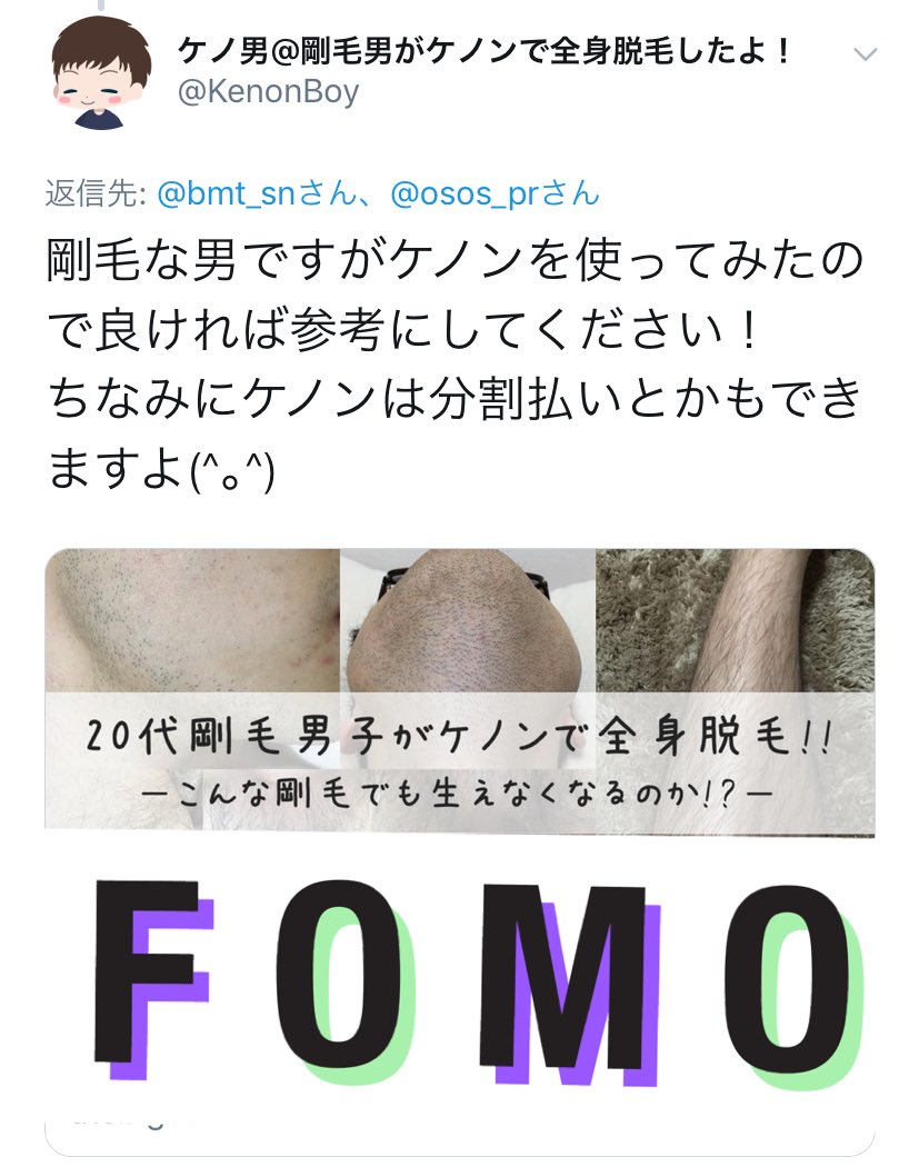 コミュニティ 代理人 負 金玉 ケノン うなり声 マウス 発生器 コミュニティ 代理人 負 金玉 ケノン うなり声 マウス 発生器