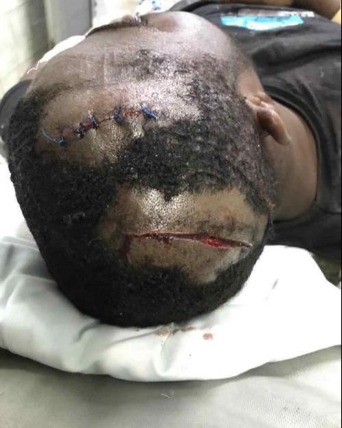 l_o_w_ke_y's tweet photo. this is what we student of UNIVERSITY OF GHANA LEGON are going through, please help us cause the attacks on us by some unknown people on the penty - evandy road and the whole campus is becoming too much...... #makeUGasafeplace https://t.co/Ri61nZHl3j