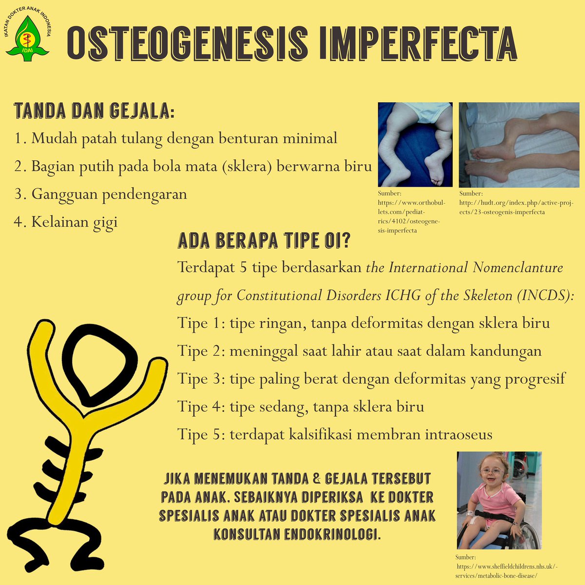 idai_tweets's tweet photo. #WishboneDay is commemorated every May 6 to raise public awareness about #OsteogenesisImperfecta (OI). The IPS Endocrinology Working Group data shows that there are 150 patients in the registry in Indonesia and they are members of Fosteo (Forum Osteogenesis Imperfecta Indonesia). https://t.co/8GqgKlpjjK